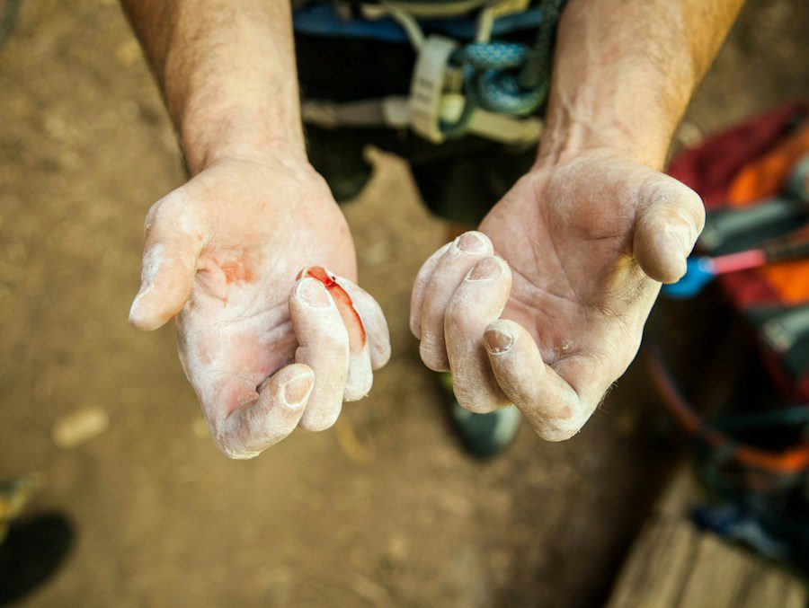 Hands with white powder for blood cleanup